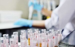 آزمایش‌های ژنتیک برای افراد دارای معلولیت رایگان است