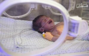 مراقبت‌های مستمر پس از ترخیص کلید سلامت پایدار نوزادان نارس