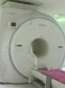 راه‌اندازی نخستین دستگاه MRI بیماران تالاسمی در هرمزگان